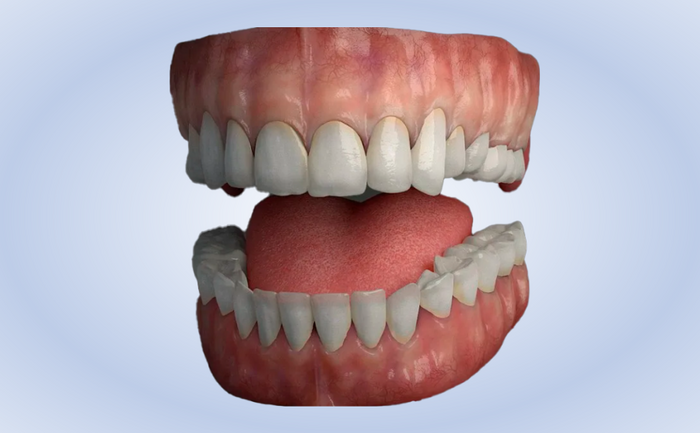 3D модель челюсти