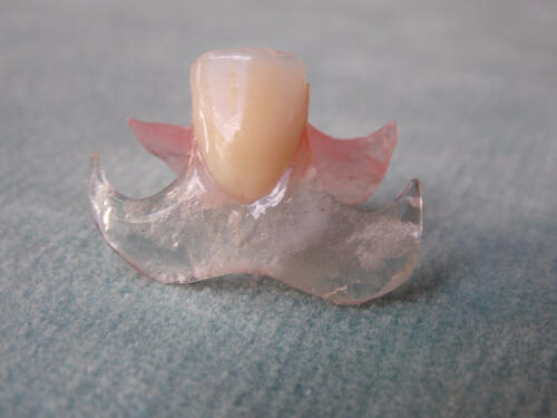 Единичный зубной протез